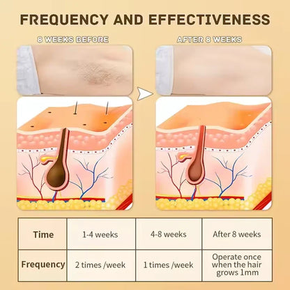 IPL Laser Hair Removal | The Leading At-Home Solution for Smooth Skin